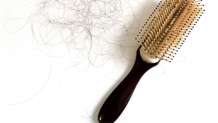 PCOS and Hair Loss Why It Happens and How to Slow It Down