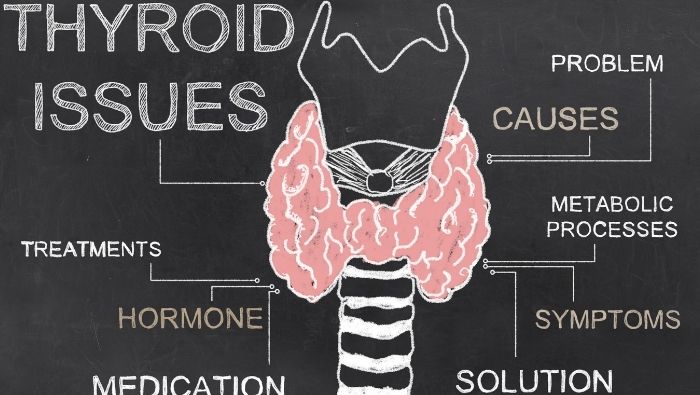 PCOS and Thyroid Why These Two Conditions So Often Go Together